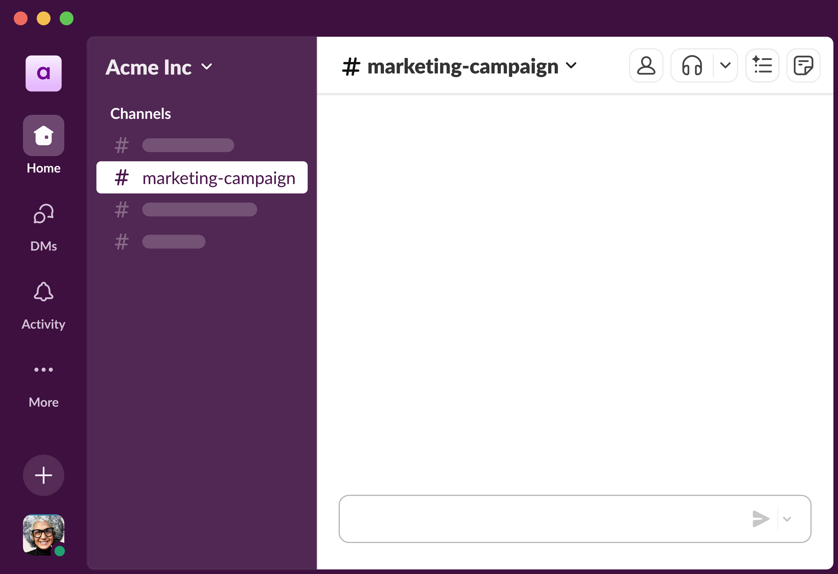 Project management feature